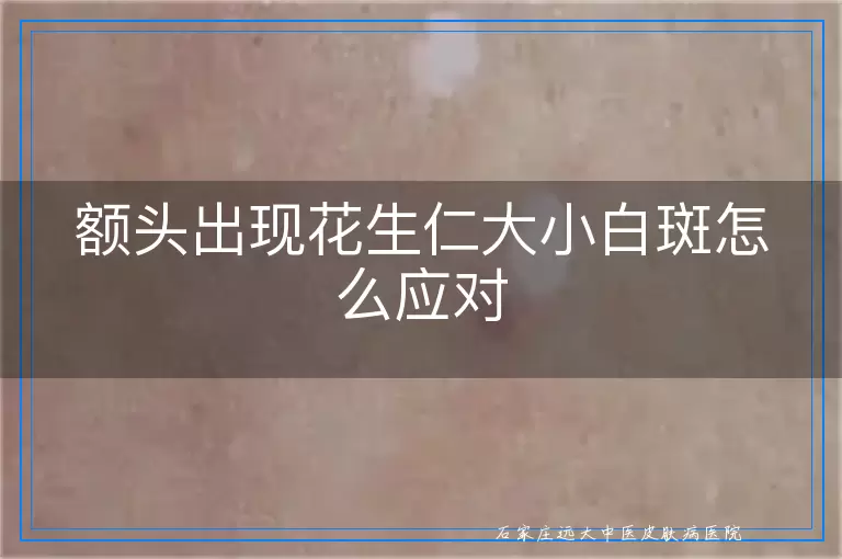 额头出现花生仁大小白斑怎么应对