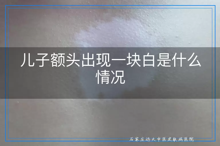 儿子额头出现一块白是什么情况