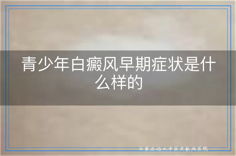 青少年白癜风早期症状是什么样的