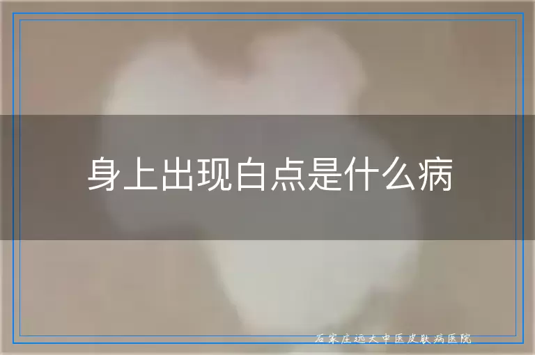 身上出现白点是什么病