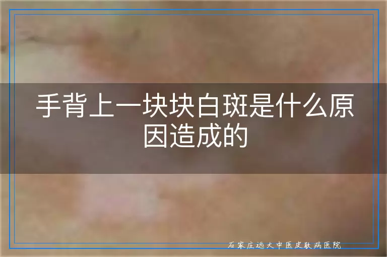 手背上一块块白斑是什么原因造成的