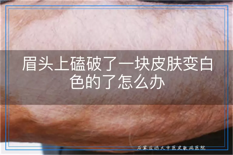 眉头上磕破了一块皮肤变白色的了怎么办