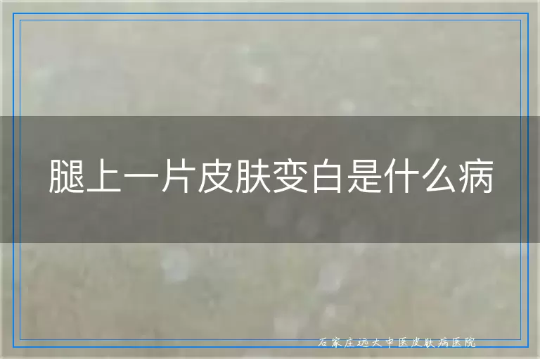 腿上一片皮肤变白是什么病
