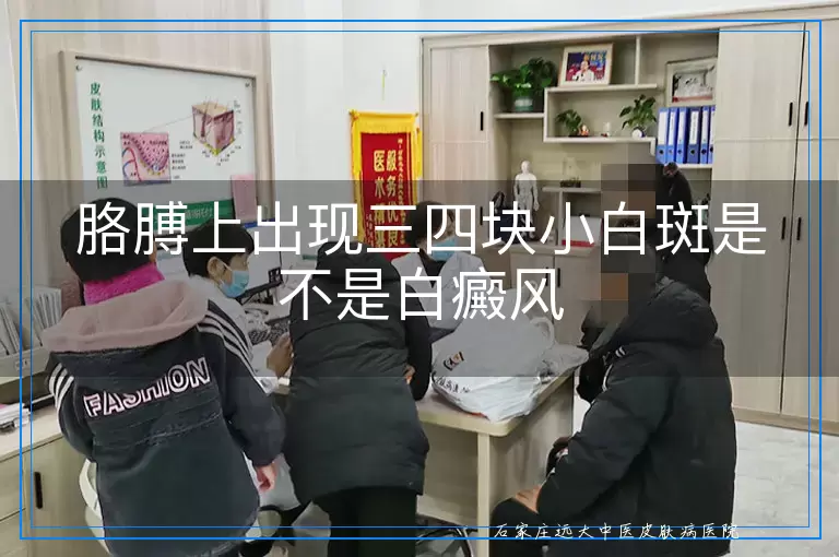 胳膊上出现三四块小白斑是不是白癜风