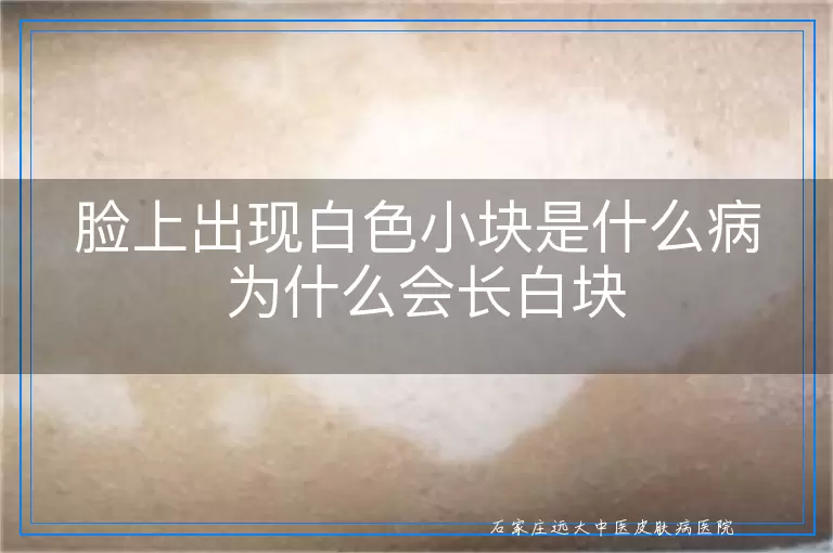 脸上出现白色小块是什么病 为什么会长白块