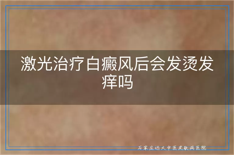 激光治疗白癜风后会发烫发痒吗