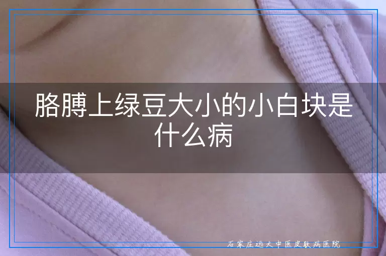 胳膊上绿豆大小的小白块是什么病