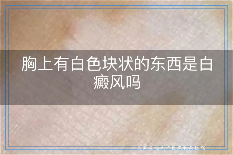 胸上有白色块状的东西是白癜风吗