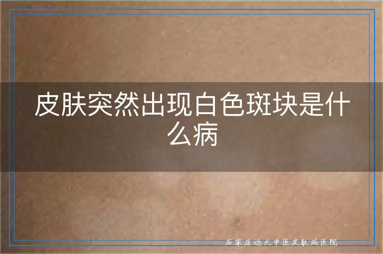 皮肤突然出现白色斑块是什么病