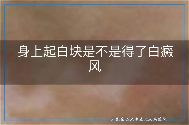 身上起白块是不是得了白癜风