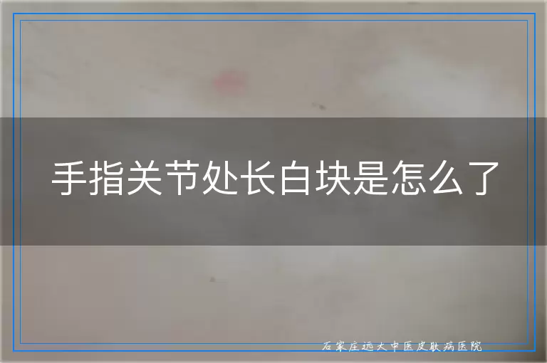手指关节处长白块是怎么了