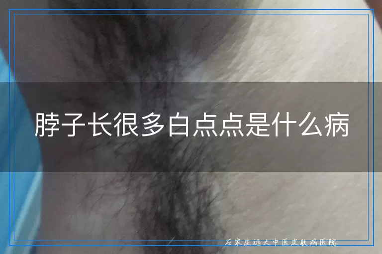 脖子长很多白点点是什么病