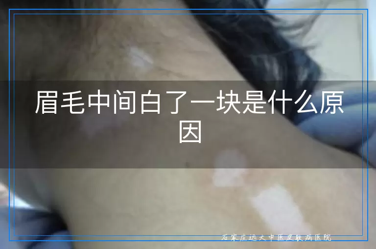 眉毛中间白了一块是什么原因