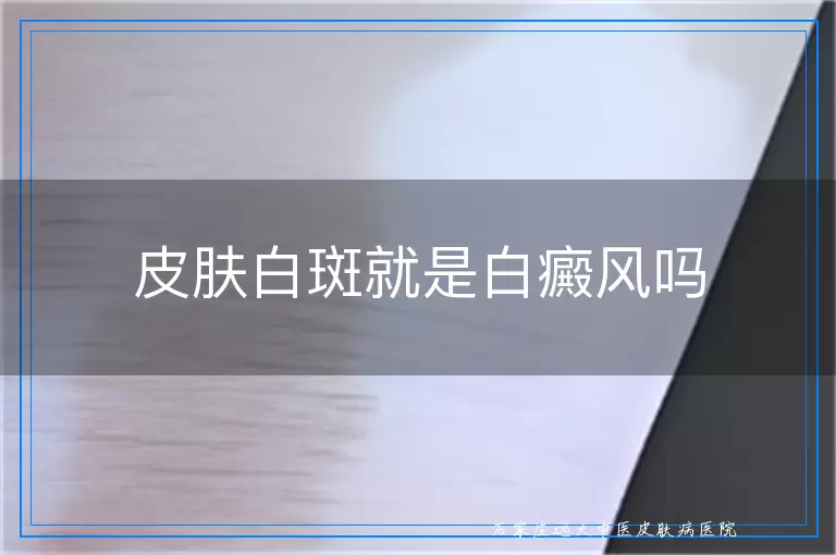 皮肤白斑就是白癜风吗