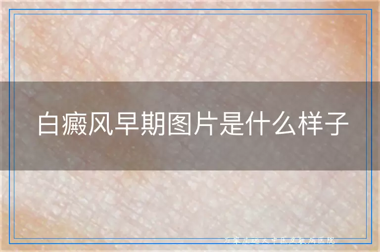 白癜风早期图片是什么样子