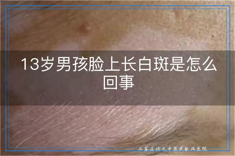 13岁男孩脸上长白斑是怎么回事