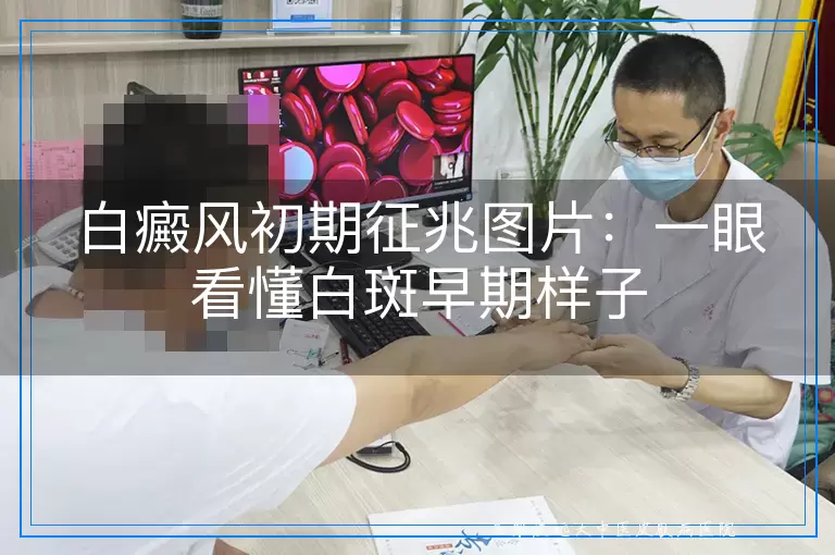 白癜风初期征兆图片:一眼看懂白斑早期样子