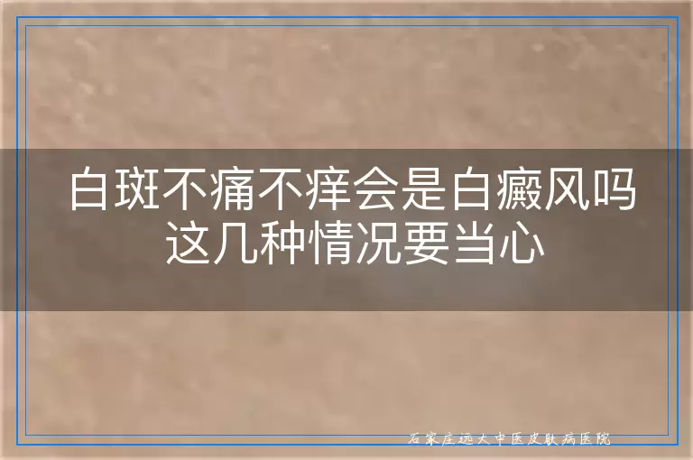 白斑不痛不痒会是白癜风吗 这几种情况要当心