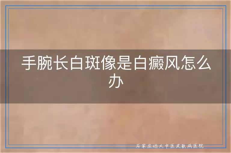 手腕长白斑像是白癜风怎么办