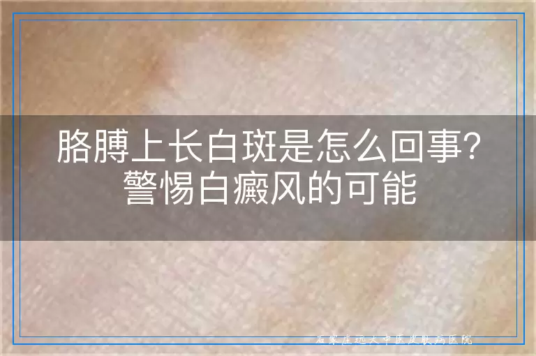 胳膊上长白斑是怎么回事?警惕白癜风的可能