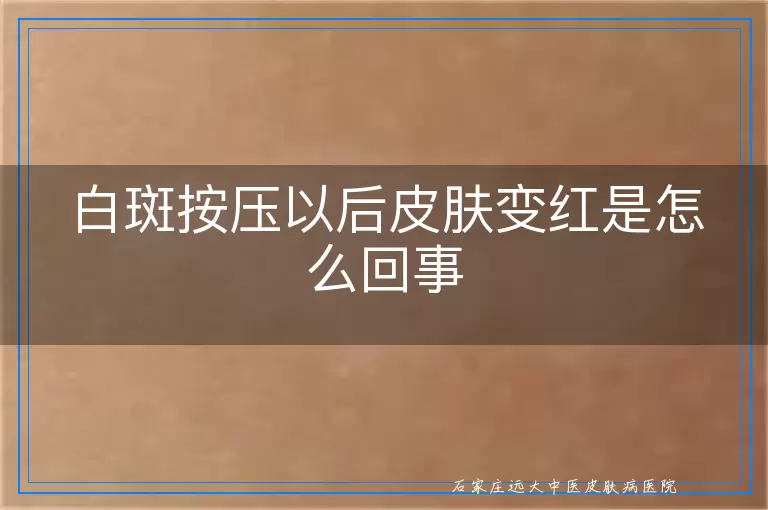 白斑按压以后皮肤变红是怎么回事