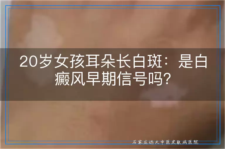 20岁女孩耳朵长白斑：是白癜风早期信号吗？