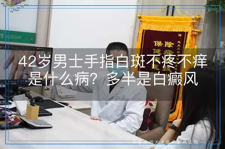 42岁男士手指白斑不疼不痒是什么病？多半是白癜风