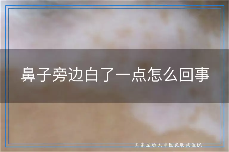 鼻子旁边白了一点怎么回事