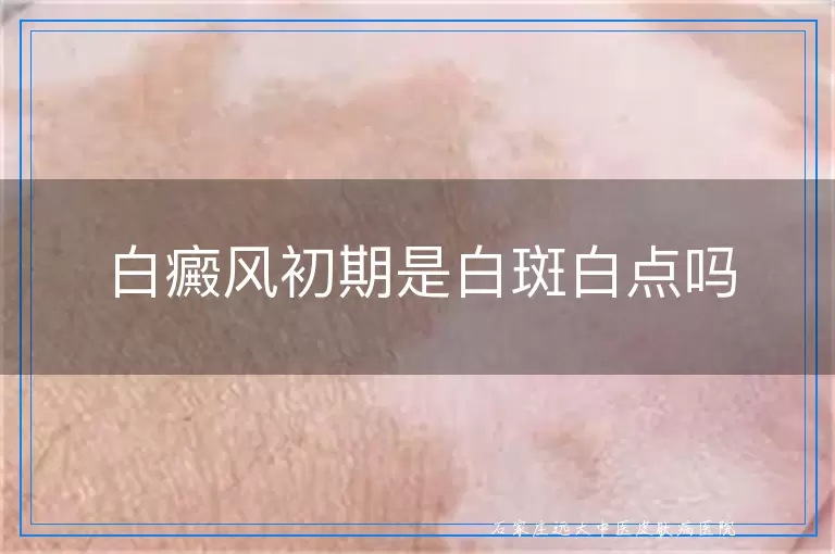 白癜风初期是白斑白点吗