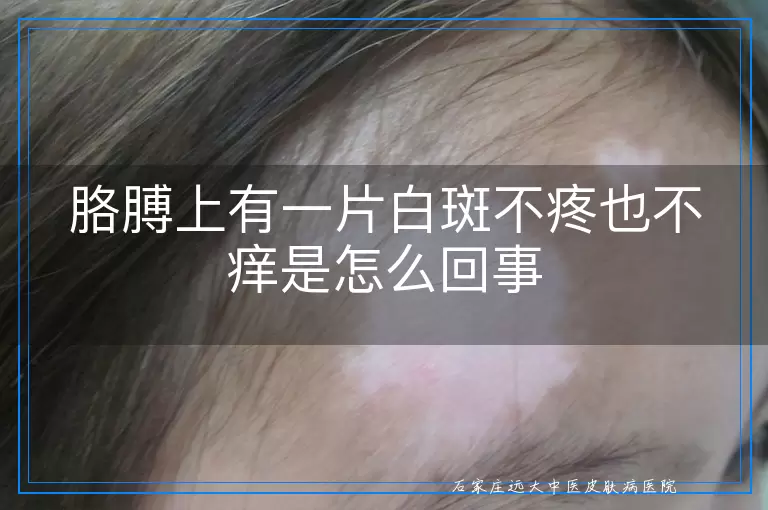 胳膊上有一片白斑不疼也不痒是怎么回事