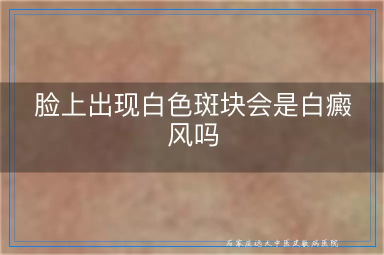 脸上出现白色斑块会是白癜风吗