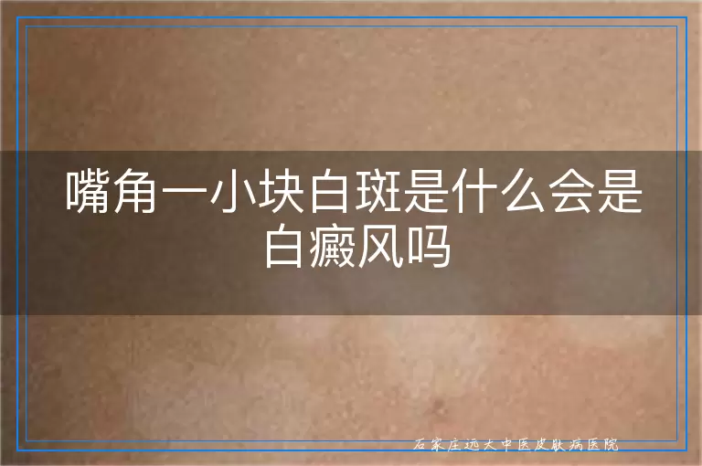 嘴角一小块白斑是什么会是白癜风吗