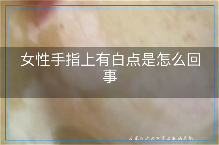 女性手指上有白点是怎么回事
