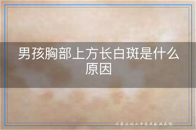 男孩胸部上方长白斑是什么原因