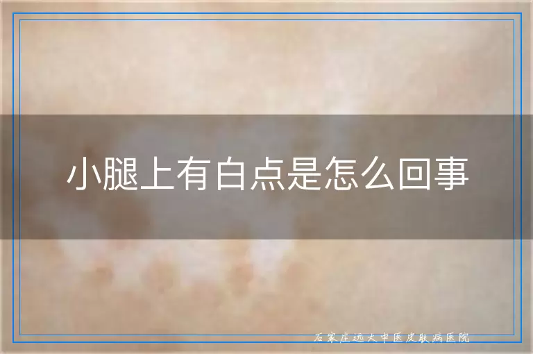 小腿上有白点是怎么回事
