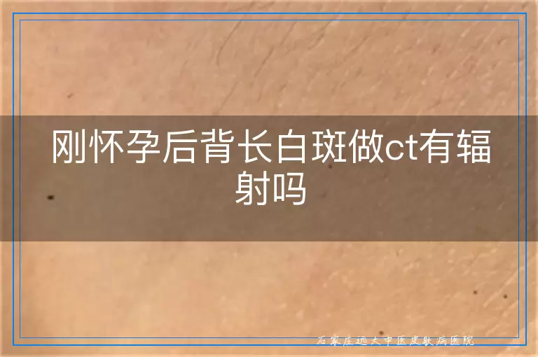 刚怀孕后背长白斑做ct有辐射吗
