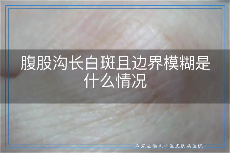 腹股沟长白斑且边界模糊是什么情况