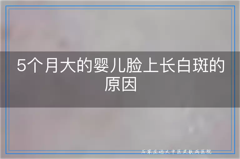 5个月大的婴儿脸上长白斑的原因