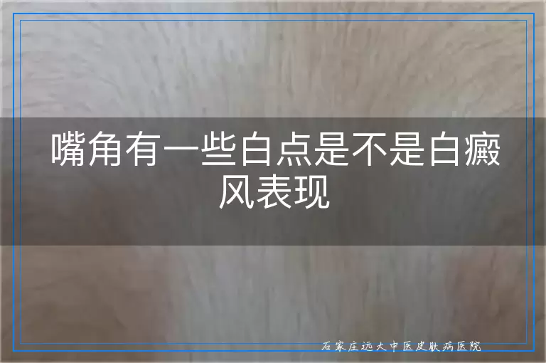嘴角有一些白点是不是白癜风表现