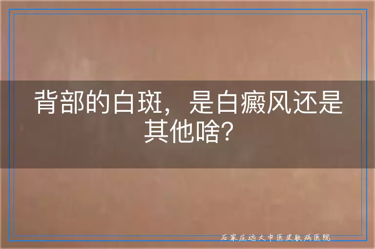 背部的白斑，是白癜风还是其他啥？
