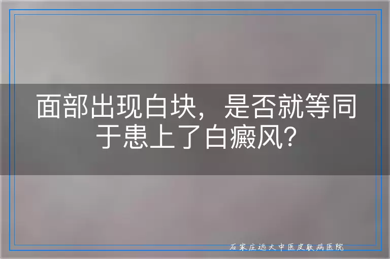 面部出现白块，是否就等同于患上了白癜风？