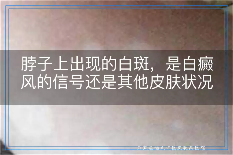 脖子上出现的白斑，是白癜风的信号还是其他皮肤状况？
