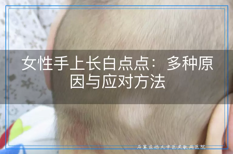 女性手上长白点点：多种原因与应对方法