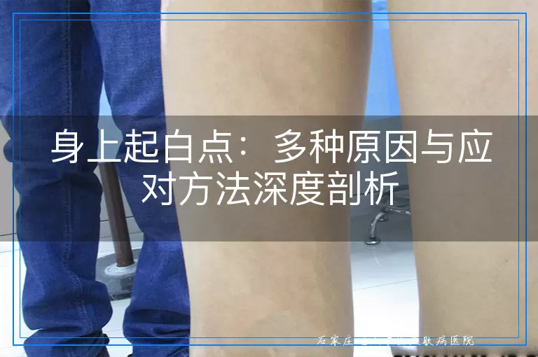身上起白点：多种原因与应对方法深度剖析