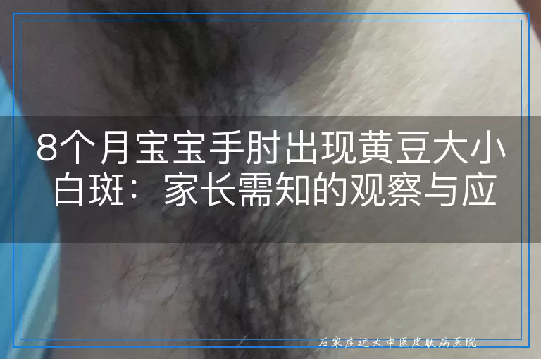 8个月宝宝手肘出现黄豆大小白斑：家长需知的观察与应对指南