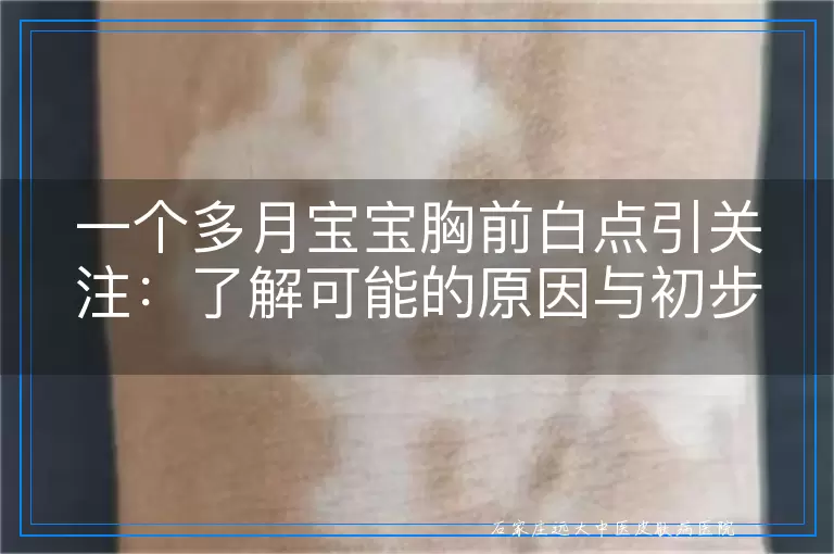 一个多月宝宝胸前白点引关注：了解可能的原因与初步观察指南
