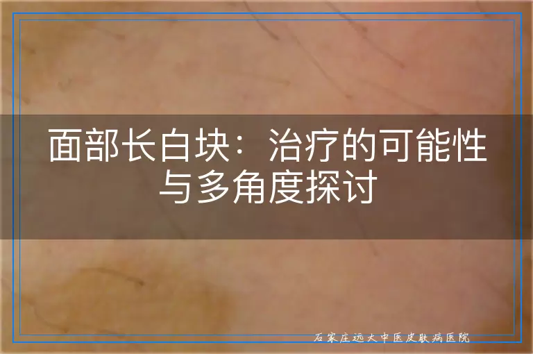 面部长白块：治疗的可能性与多角度探讨