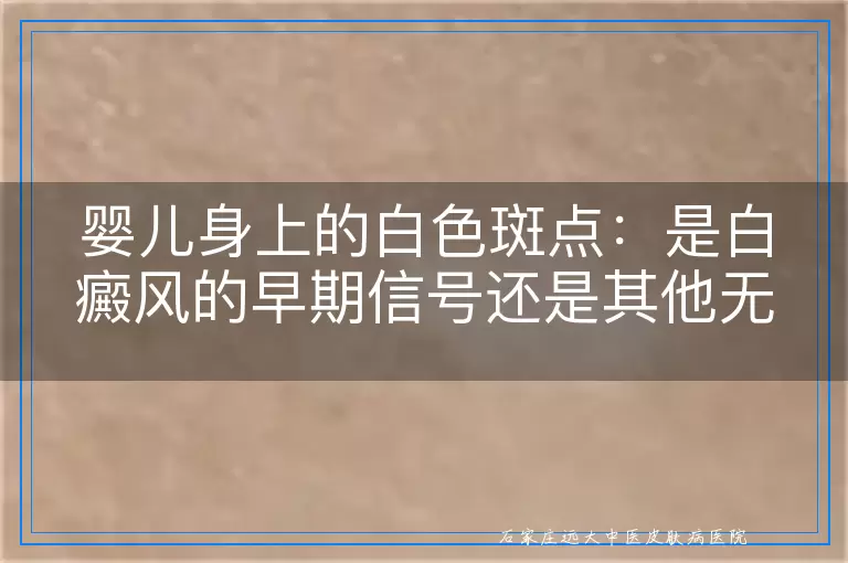 婴儿身上的白色斑点：是白癜风的早期信号还是其他无害现象？
