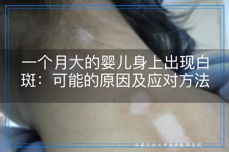 一个月大的婴儿身上出现白斑：可能的原因及应对方法