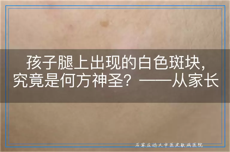 孩子腿上出现的白色斑块，究竟是何方神圣？——从家长的角度谈理解与应对